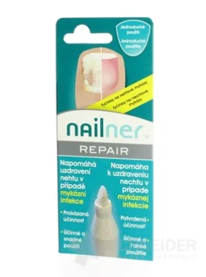 NAILNER REPAIR NA MYKÓZU NECHTOV
