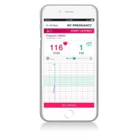 Miniland SweetBeat Detektor srdcovej frekvencie plodu