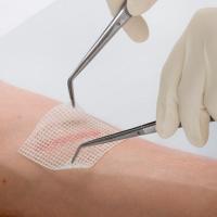 LEUKOPLAST CUTICELL CLASSIC