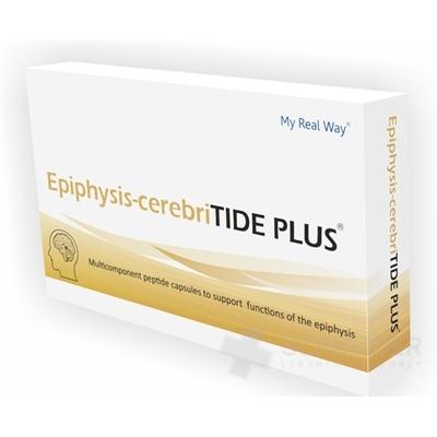Epiphysis-cerebriTIDE PLUS